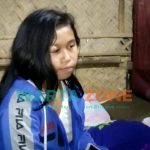 Foto: Sofiatun (16), warga Dusun Sukomoelang, Desa Panduman, Kecamatan Jelbuk, Jember, menderita Tumor Palpebra pada kelopak mata sebelah kanan.