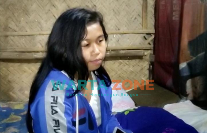 Foto: Sofiatun (16), warga Dusun Sukomoelang, Desa Panduman, Kecamatan Jelbuk, Jember, menderita Tumor Palpebra pada kelopak mata sebelah kanan.