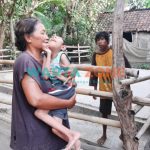 Rudi (18) dan Rosidi (12), kakak beradik yang diketahui mengidap Treacher Collins Syndrome (TCS), warga Dusun Wringinsari, Desa Jatimulyo, Kecamatan Jenggawah, Jember.