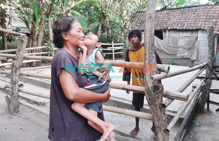 Rudi (18) dan Rosidi (12), kakak beradik yang diketahui mengidap Treacher Collins Syndrome (TCS), warga Dusun Wringinsari, Desa Jatimulyo, Kecamatan Jenggawah, Jember.