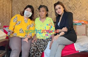 Berni Jember Gandeng Relawan Rengganis, Pesankan Kaki Palsu Untuk Korban Kecelakaan