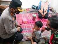 Kapolresta Sidoarjo Besuk Bocah Penderita Gastroschisis di Tanggulangin