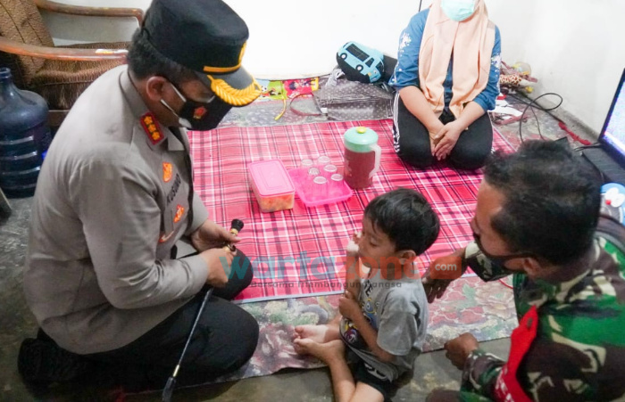 Kapolresta Sidoarjo Besuk Bocah Penderita Gastroschisis di Tanggulangin