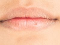 Cara Ampuh Mengatasi Bibir Kering dan Pecah