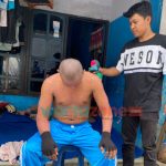 Sekujur Tubuh Banyak Ruam, Warga Jember Ini Tak Bisa Bekerja dan Dikucilkan Tetangga Rumah