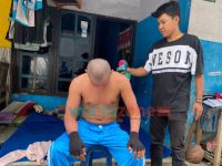 Sekujur Tubuh Banyak Ruam, Warga Jember Ini Tak Bisa Bekerja dan Dikucilkan Tetangga Rumah