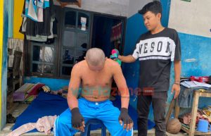 Sekujur Tubuh Banyak Ruam, Warga Jember Ini Tak Bisa Bekerja dan Dikucilkan Tetangga Rumah