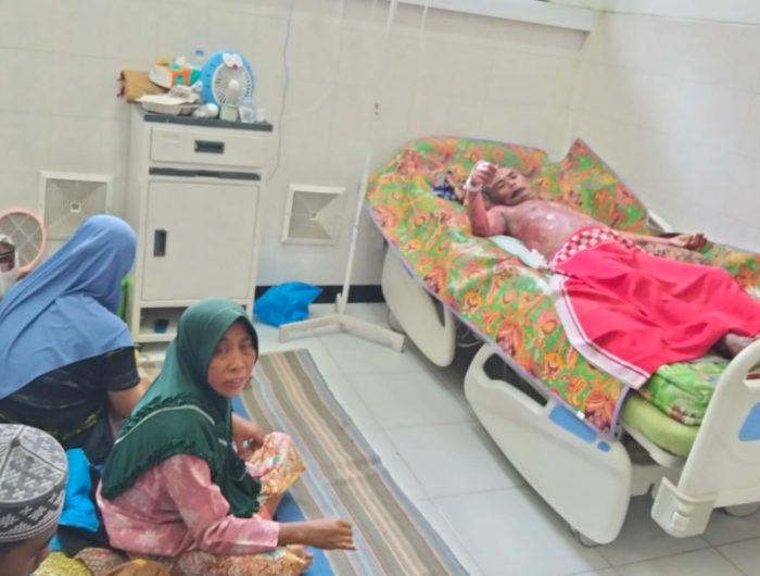 FOTO: Salah satu pasien saat menjalani perawatan gratis dari program UHC di RSUD Moh Anwar Sumenep.